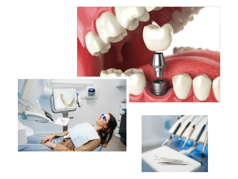 Dental Implants in Swiss Cottage London