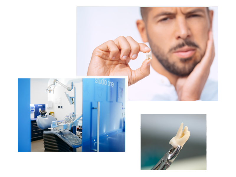 Tooth Extraction in Swiss Cottage